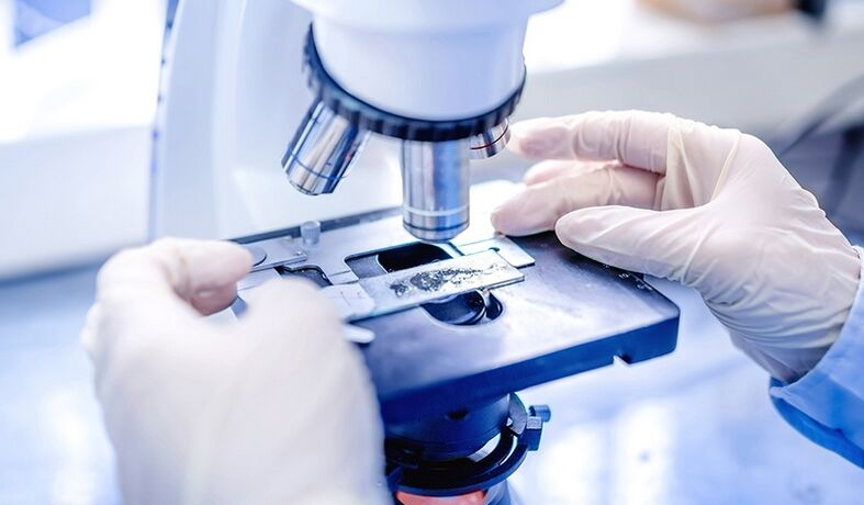 Labordiagnostik Zehennagelpilz