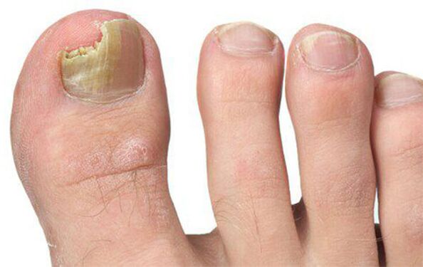 Różne formy grzybów