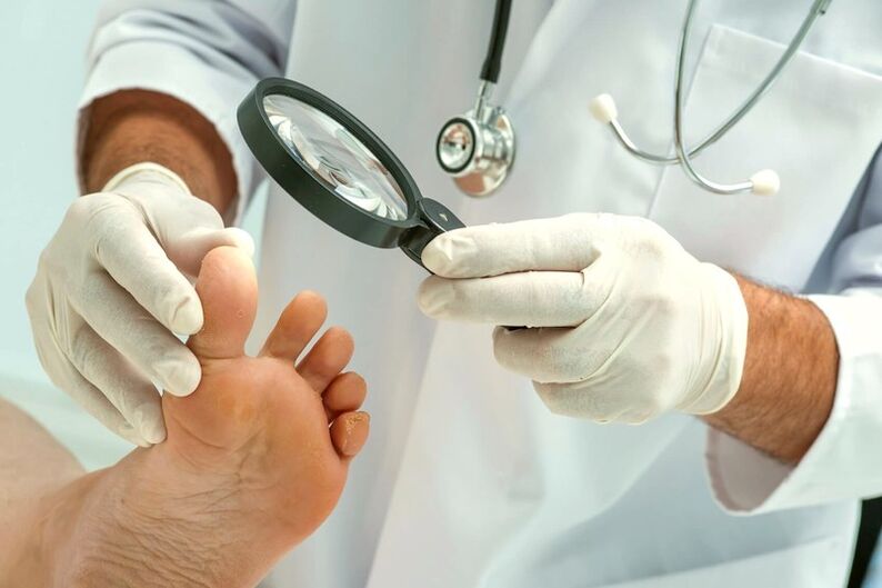 dermatolog badający paznokcie u nóg