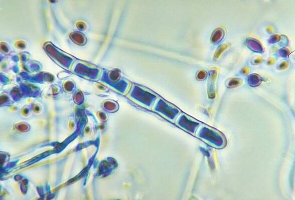 Grzyb Trichophyton rubrum pod mikroskopem