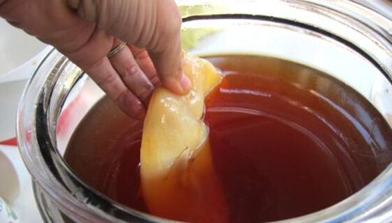 Kombucha w leczeniu grzybicy paznokci